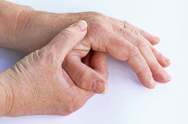 idosa com artrite